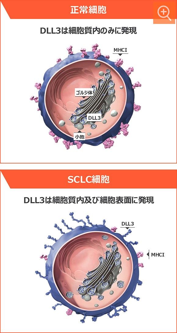 図6 正常細胞とSCLC細胞のDLL3発現