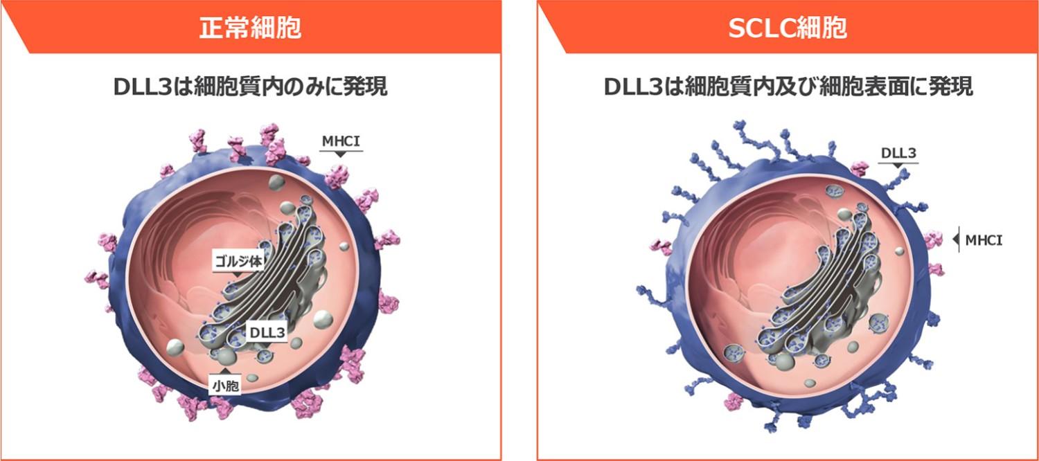 図6 正常細胞とSCLC細胞のDLL3発現